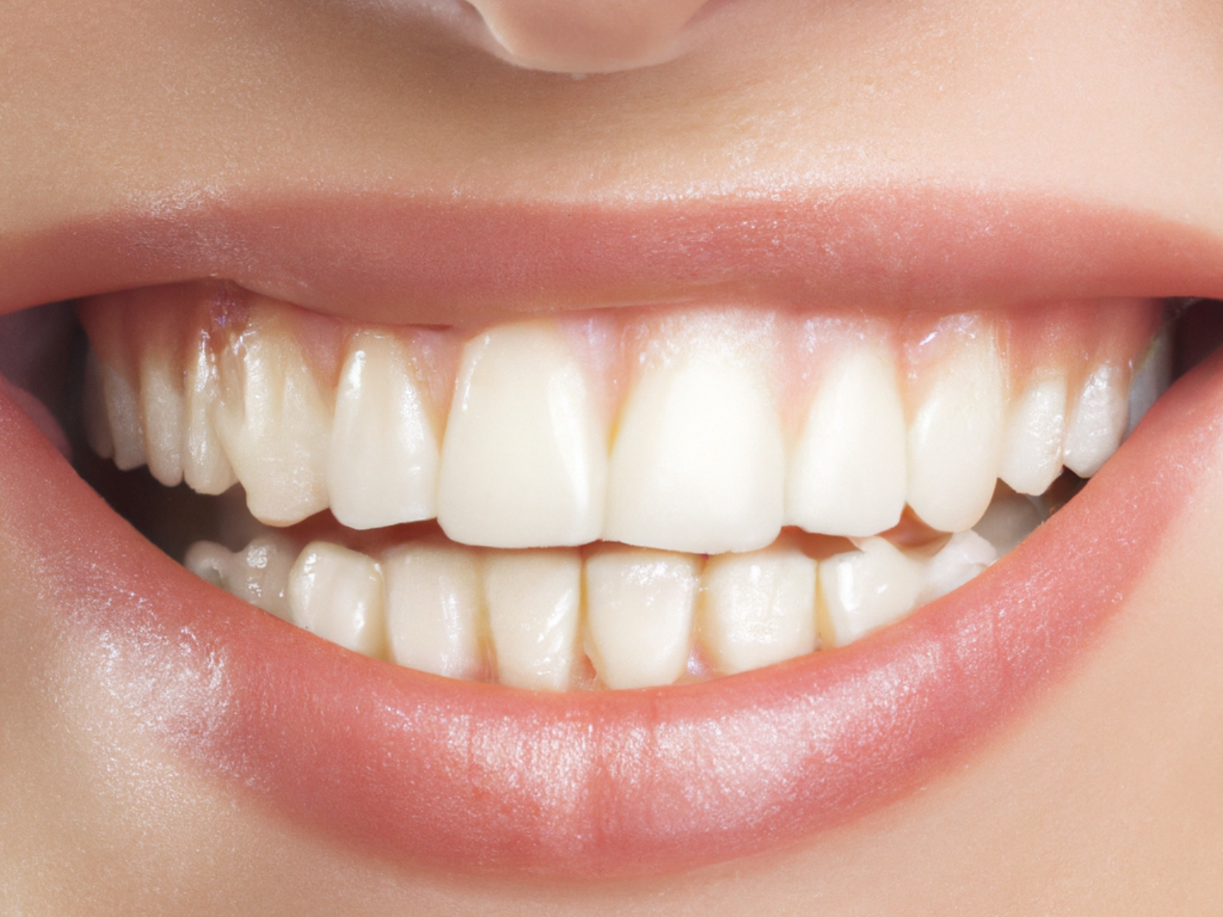 Capa: Remédio para inflamação na gengiva: o que usar e quando — foto: Kasim H/Pexels